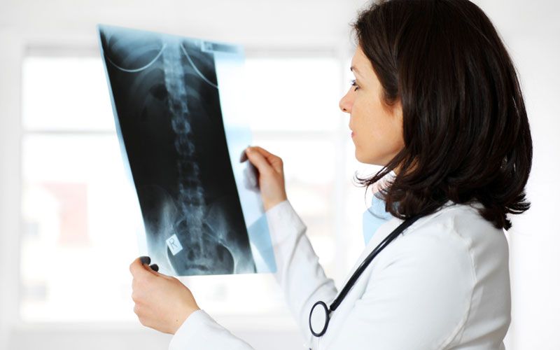 X-Rays at home Ιατρός ακτινολόγος αναλύει μια ακτινογραφία της μέσης ΟΜΣΣ 