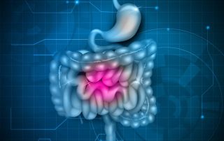 idiopathic inflammatory bowel disease ATHENS CALL NOW